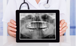 Digitales Röntgen Digitales Röntgen